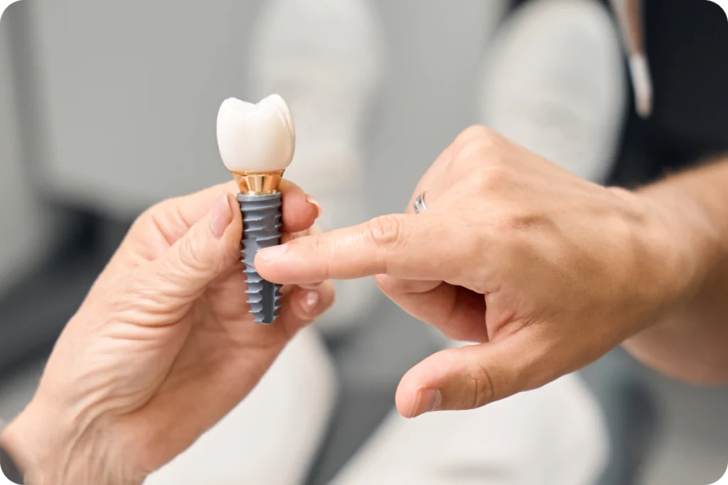 Implants dentaires