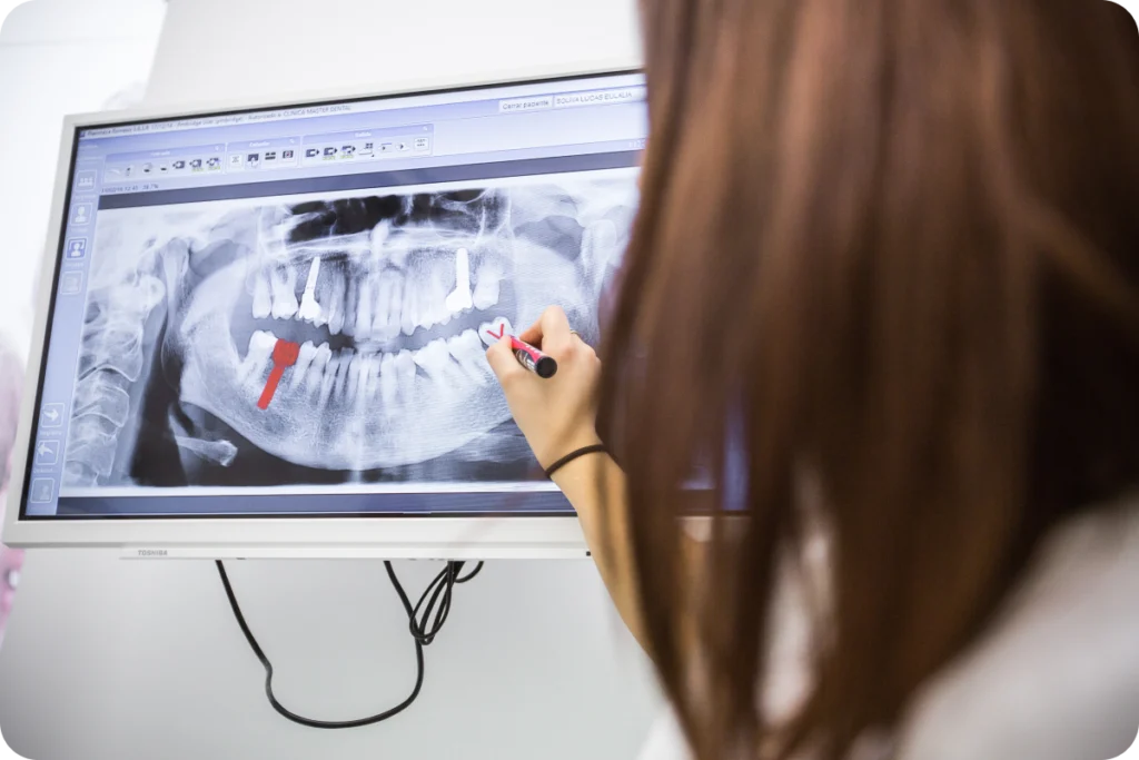 Praticienne analysant une radiographie dentaire à l'écran