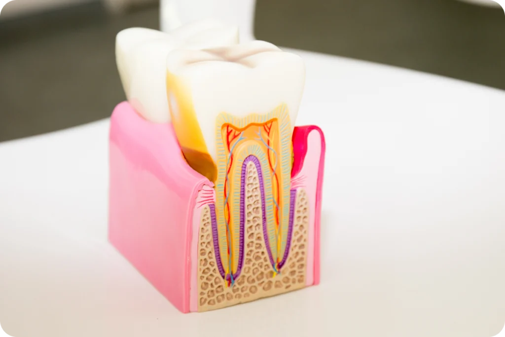 Illustration en coupe d'une dent montrant le nerf dentaire
