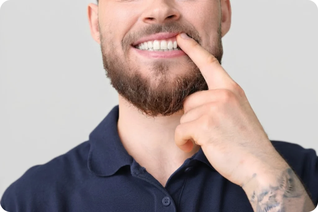 Homme souriant montrant du doigt sa gencive et ses dents